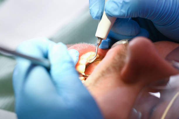 Urgent Tooth Repair in NJ