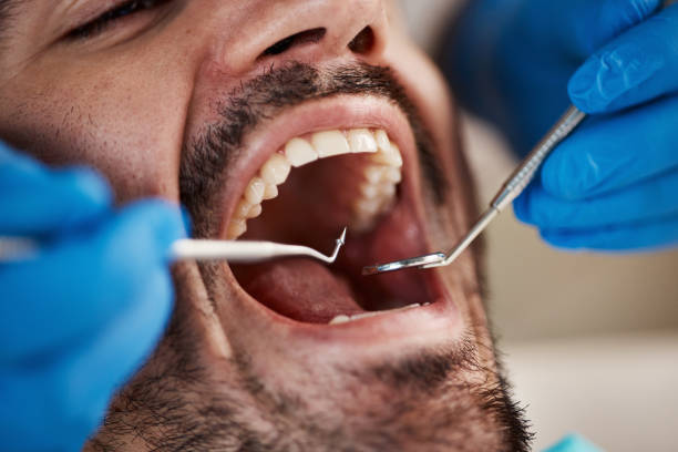 Best Broken Tooth Emergency  in Demarest, NJ