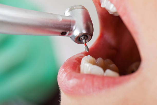 Best Tooth Infection Emergency Dentist  in Demarest, NJ